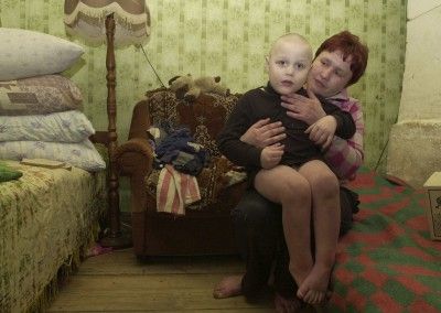 09 Muchas son las consecuencias del accidente nuclear en Bielorrusia